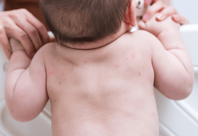 触れ合うスキンケアタイムを大切に！デリケートな赤ちゃんの肌を守る秘訣