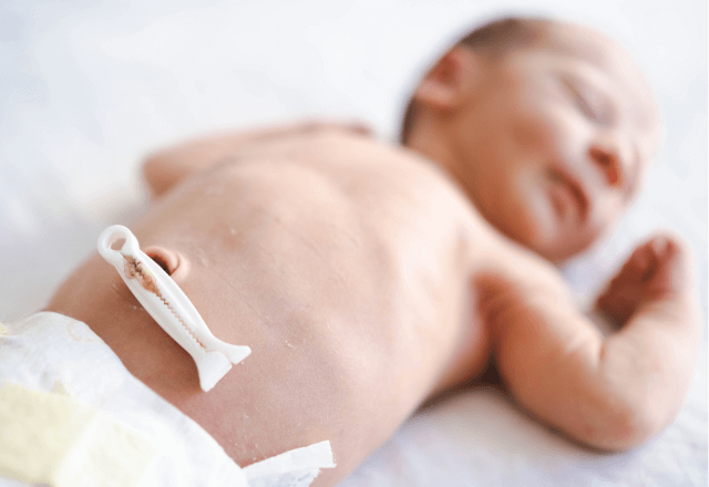 へその緒が取れたらどうする？正しい消毒方法と注意すべき症状を解説