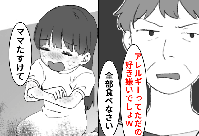 「アレルギーってただの好き嫌いでしょ？（笑）」娘に無理やり食べさせる義母…直後⇒「ママ助けて」容態が急変すると…！？
