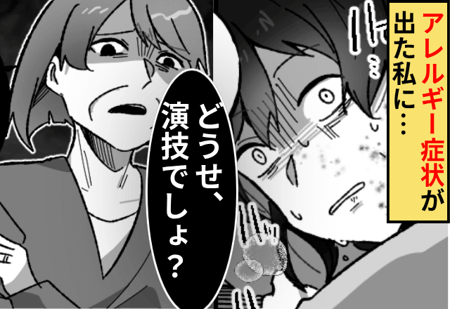 アレルギー症状が現れた私に…義母「どうせ演技でしょ（笑）」そのまま放置された結果⇒”まさかの事態”に義母「へ？」