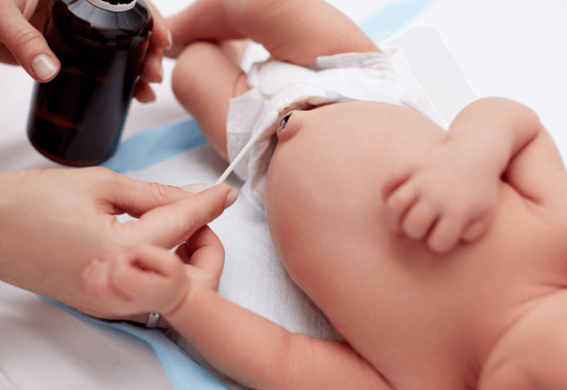 新生児のおへそケアを徹底解説！正しい消毒方法とトラブル対処法
